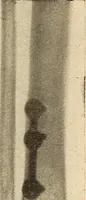 An illustration from Fractures and dislocations, diagnosis and treatment (1915)