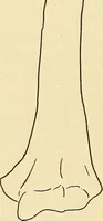 An illustration from Fractures and dislocations, diagnosis and treatment (1915)