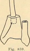 Picture 481 of 481 from Fractures and dislocations, diagnosis and treatment (1915), leaf 816