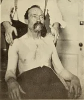 Picture 39 of 481 from Fractures and dislocations, diagnosis and treatment (1915), leaf 84