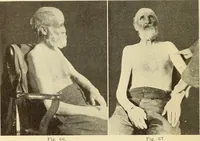Picture 40 of 481 from Fractures and dislocations, diagnosis and treatment (1915), leaf 85