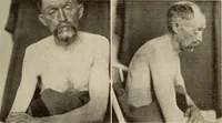Picture 41 of 481 from Fractures and dislocations, diagnosis and treatment (1915), leaf 86