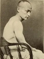 Picture 50 of 481 from Fractures and dislocations, diagnosis and treatment (1915), leaf 94
