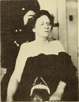 Picture 51 of 481 from Fractures and dislocations, diagnosis and treatment (1915), leaf 95