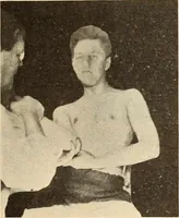 An illustration from Fractures and dislocations, diagnosis and treatment (1915)