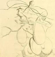 Picture 23 of 60 from Frederici Ruyschii ... Observationum anatomico-chirurgicarum centuria : accedit catalogus rariorum, quae in museo Ruyschiano asservantur ... (1691), leaf 100