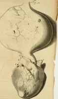 An illustration from Frederici Ruyschii ... Observationum anatomico-chirurgicarum centuria : accedit catalogus rariorum, quae in museo Ruyschiano asservantur ... (1691)