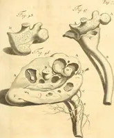 Picture 28 of 60 from Frederici Ruyschii ... Observationum anatomico-chirurgicarum centuria : accedit catalogus rariorum, quae in museo Ruyschiano asservantur ... (1691), leaf 140