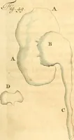Picture 30 of 60 from Frederici Ruyschii ... Observationum anatomico-chirurgicarum centuria : accedit catalogus rariorum, quae in museo Ruyschiano asservantur ... (1691), leaf 144