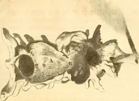 An illustration from Frederici Ruyschii ... Observationum anatomico-chirurgicarum centuria : accedit catalogus rariorum, quae in museo Ruyschiano asservantur ... (1691)