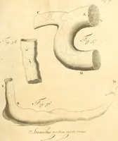 An illustration from Frederici Ruyschii ... Observationum anatomico-chirurgicarum centuria : accedit catalogus rariorum, quae in museo Ruyschiano asservantur ... (1691)