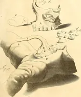 An illustration from Frederici Ruyschii ... Observationum anatomico-chirurgicarum centuria : accedit catalogus rariorum, quae in museo Ruyschiano asservantur ... (1691)