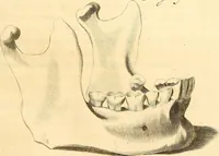 Picture 43 of 60 from Frederici Ruyschii ... Observationum anatomico-chirurgicarum centuria : accedit catalogus rariorum, quae in museo Ruyschiano asservantur ... (1691), leaf 194