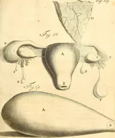 An illustration from Frederici Ruyschii ... Observationum anatomico-chirurgicarum centuria : accedit catalogus rariorum, quae in museo Ruyschiano asservantur ... (1691)