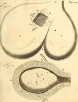 An illustration from Frederici Ruyschii ... Observationum anatomico-chirurgicarum centuria : accedit catalogus rariorum, quae in museo Ruyschiano asservantur ... (1691)