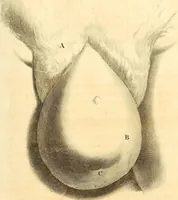 Picture 6 of 60 from Frederici Ruyschii ... Observationum anatomico-chirurgicarum centuria : accedit catalogus rariorum, quae in museo Ruyschiano asservantur ... (1691), leaf 22