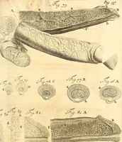 An illustration from Frederici Ruyschii ... Observationum anatomico-chirurgicarum centuria : accedit catalogus rariorum, quae in museo Ruyschiano asservantur ... (1691)