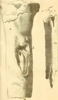 An illustration from Frederici Ruyschii ... Observationum anatomico-chirurgicarum centuria : accedit catalogus rariorum, quae in museo Ruyschiano asservantur ... (1691)