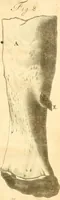 An illustration from Frederici Ruyschii ... Observationum anatomico-chirurgicarum centuria : accedit catalogus rariorum, quae in museo Ruyschiano asservantur ... (1691)