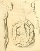 Picture 12 of 60 from Frederici Ruyschii ... Observationum anatomico-chirurgicarum centuria : accedit catalogus rariorum, quae in museo Ruyschiano asservantur ... (1691), leaf 52