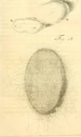 Picture 14 of 60 from Frederici Ruyschii ... Observationum anatomico-chirurgicarum centuria : accedit catalogus rariorum, quae in museo Ruyschiano asservantur ... (1691), leaf 60