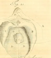 An illustration from Frederici Ruyschii ... Observationum anatomico-chirurgicarum centuria : accedit catalogus rariorum, quae in museo Ruyschiano asservantur ... (1691)