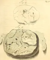 An illustration from Frederici Ruyschii ... Observationum anatomico-chirurgicarum centuria : accedit catalogus rariorum, quae in museo Ruyschiano asservantur ... (1691)