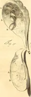 Picture 20 of 60 from Frederici Ruyschii ... Observationum anatomico-chirurgicarum centuria : accedit catalogus rariorum, quae in museo Ruyschiano asservantur ... (1691), leaf 90