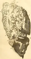 An illustration from Frederici Ruyschii ... Observationum anatomico-chirurgicarum centuria : accedit catalogus rariorum, quae in museo Ruyschiano asservantur ... (1691)
