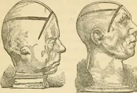 An illustration from The fundamental principles of phrenology are the only principles capable of being reconciled with the immateriality and immortality of the soul (1868)