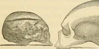 An illustration from The fundamental principles of phrenology are the only principles capable of being reconciled with the immateriality and immortality of the soul (1868)