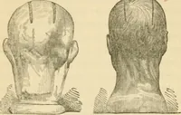 An illustration from The fundamental principles of phrenology are the only principles capable of being reconciled with the immateriality and immortality of the soul (1868)