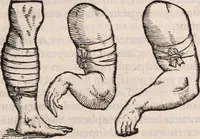 An illustration from Galeni omnia quae extant opera : in latinum sermonem conuersa (1565)