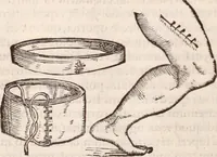 Picture 99 of 246 from Galeni omnia quae extant opera : in latinum sermonem conuersa (1565), leaf 1023