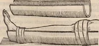 An illustration from Galeni omnia quae extant opera : in latinum sermonem conuersa (1565)