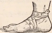 An illustration from Galeni omnia quae extant opera : in latinum sermonem conuersa (1565)