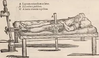 An illustration from Galeni omnia quae extant opera : in latinum sermonem conuersa (1565)