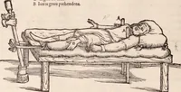 An illustration from Galeni omnia quae extant opera : in latinum sermonem conuersa (1565)