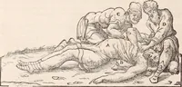 Picture 141 of 246 from Galeni omnia quae extant opera : in latinum sermonem conuersa (1565), leaf 1131