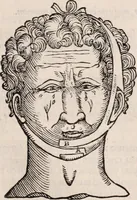An illustration from Galeni omnia quae extant opera : in latinum sermonem conuersa (1565)