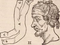 An illustration from Galeni omnia quae extant opera : in latinum sermonem conuersa (1565)