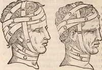 An illustration from Galeni omnia quae extant opera : in latinum sermonem conuersa (1565)