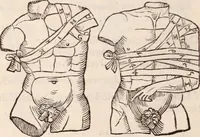 An illustration from Galeni omnia quae extant opera : in latinum sermonem conuersa (1565)