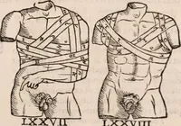 An illustration from Galeni omnia quae extant opera : in latinum sermonem conuersa (1565)