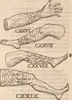 An illustration from Galeni omnia quae extant opera : in latinum sermonem conuersa (1565)