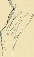 An illustration from Gazette des beaux-arts (1859)