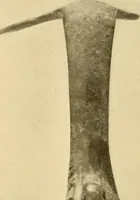 An illustration from Greek, Etruscan and Roman bronzes (1915)
