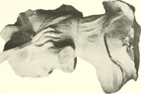 An illustration from Greek moulds (1903)