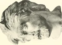 An illustration from Greek sculpture (1903)
