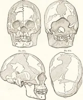 An illustration from Ilios; the city and country of the Trojans. The results of researches and discoveries on the site of Troy and throughout the Troad in the years 1871-72-73-78-79, including an autobiography of the author (1880)